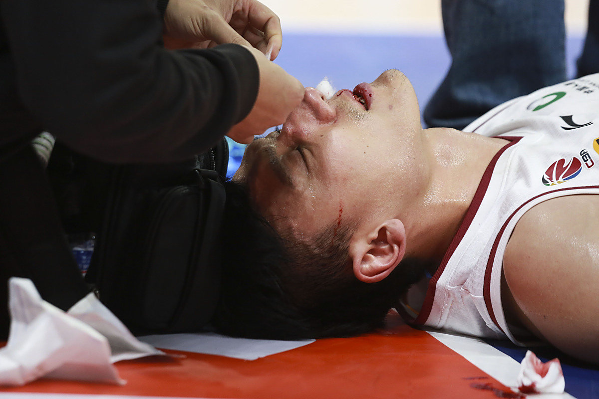 克罗地亚队长受伤：世界杯防线受挫的简单介绍